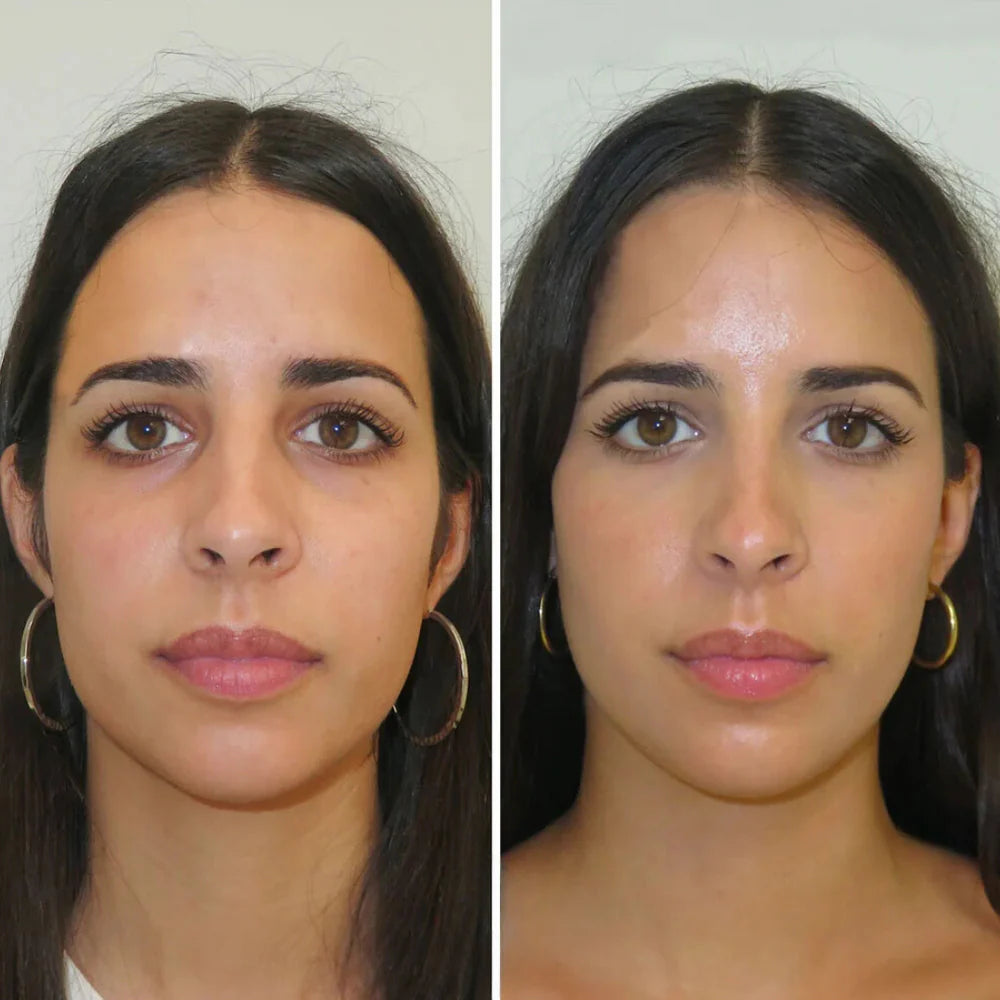 CELYN Instant antirimpel- en oogzakcrème