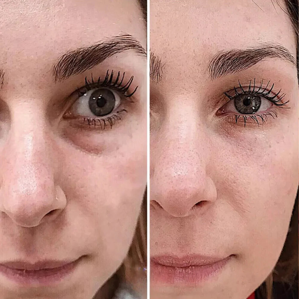 CELYN Instant Anti-Rimpel- und Oogzakcreme 