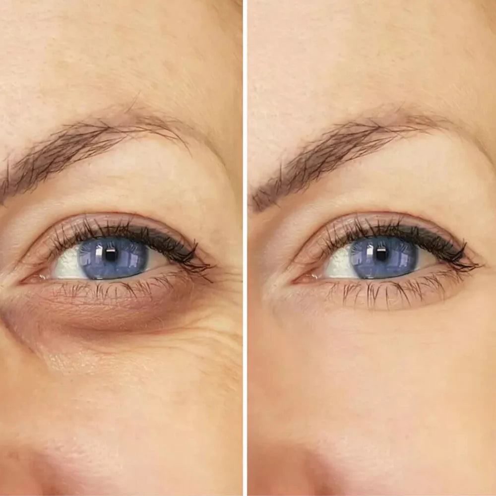 CELYN Instant Anti-Rimpel- und Oogzakcreme 
