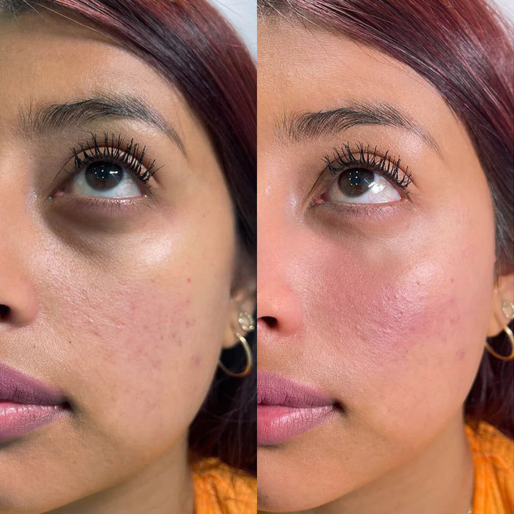 CELYN Instant Anti-Rimpel- und Oogzakcreme 