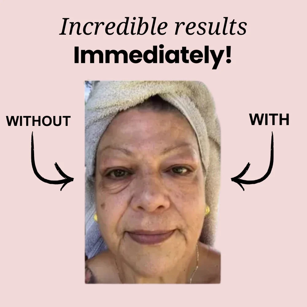 CELYN Instant Anti-Rimpel- und Oogzakcreme 