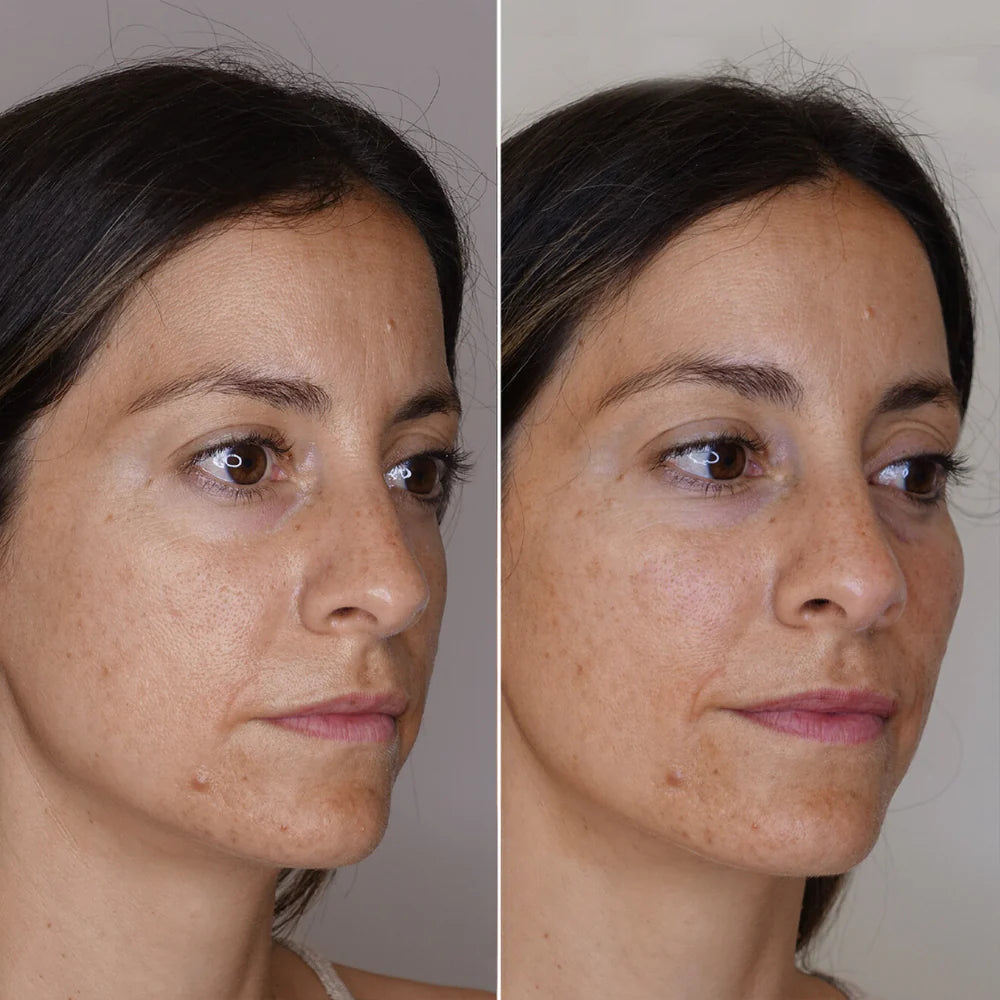CELYN Instant Anti-Rimpel- und Oogzakcreme 